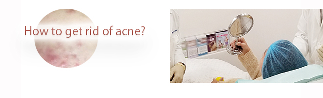 acne dermatologist