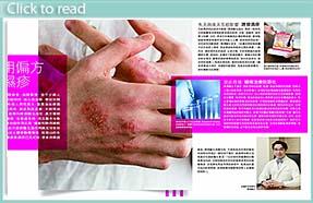 eczema specialist hong kong